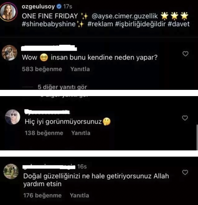 Estetik yaptıran Özge Ulusoy’un son hali sevenlerini üzdü! “İnsan bunu kendine neden yapar?”