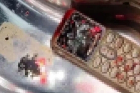 Kardeşine vermemek için cep telefonunu yuttu! 2 saat süren ameliyatla çıkartıldı… 7 Kardeşine-vermemek-için-cep-telefonunu-yuttu!-2-saat-süren-ameliyatla-çıkartıldı…