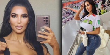 Kim-Kardashian'a-daha-çok-benzemek-isteyen-model-estetik-ameliyatından-sonra-kalp-krizi-geçirerek-öldü