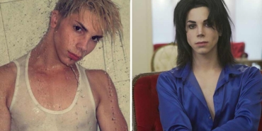 Michael-Jackson'a-benzemek-isteyen-genç-40-bin-dolardan-fazla-para-harcadı!-11-operasyon-geçirdi,-son-hali-hayrete-düşürdü