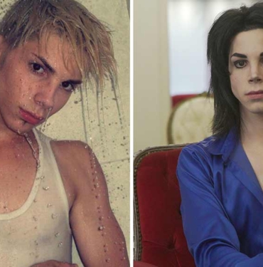 Michael Jackson'a benzemek isteyen genç 40 bin dolardan fazla para harcadı! 11 operasyon geçirdi, son hali hayrete düşürdü 7 Michael-Jackson'a-benzemek-isteyen-genç-40-bin-dolardan-fazla-para-harcadı!-11-operasyon-geçirdi,-son-hali-hayrete-düşürdü