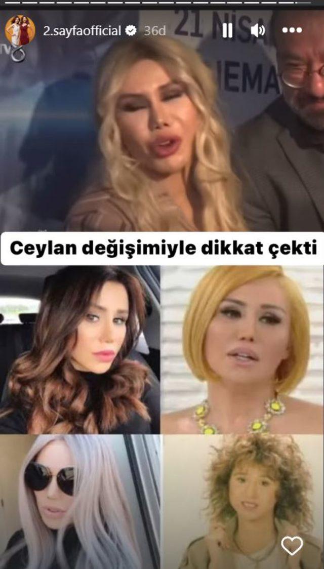 Şarkıcı Ceylan estetiğin dozunu kaçırdı, mimik yapamaz hale geldi! Görenler "Yazık bu ne hal" diyor