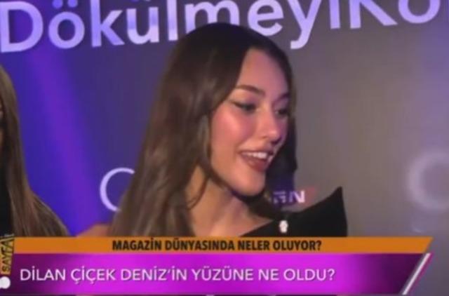 Estetik yaptıran Dilan Çiçek Deniz’in son hali beğenilmedi: "Neden kendine bunu yaptın"