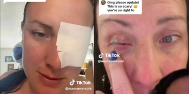 Gözüne-damla-yerine-yanlışlıkla-yapıştırıcı-sıktı--İşte-başardım,-en-aptal-insan-ödülünü-kazandım