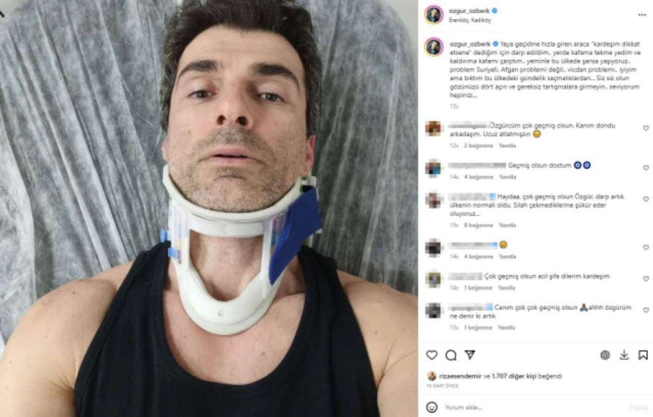 Ünlü oyuncu Özgür Özberk trafikte uyardığı şoför tarafından darbedildi: Bu ülkede şansa yaşıyoruz!