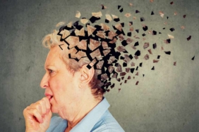 Alzheimerın ilk belirtilerinden biri olabilir: Doktorlar çok garip buldu 7 Alzheimerın-ilk-belirtilerinden-biri-olabilir--Doktorlar-çok-garip-buldu