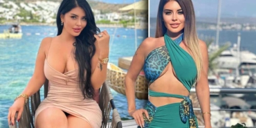 Ebru-Polat'tan-şaşırtan-açıklama--Estetik-yok,-doğuştan-gelen-bir-güzelliğim-var