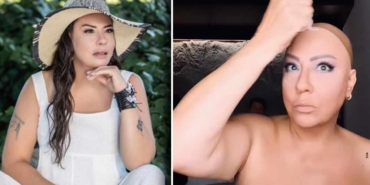 Hastalığını-açıklayan-Işın-Karaca,-peruksuz-halini-paylaştı