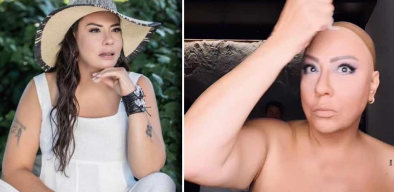 Hastalığını açıklayan Işın Karaca, peruksuz halini paylaştı