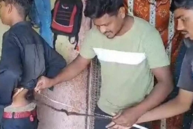 Hindistan’da-belinde-60-cm’lik-kuyruk-çıkan-çocuğu-’Tanrı’-ilan-ettiler