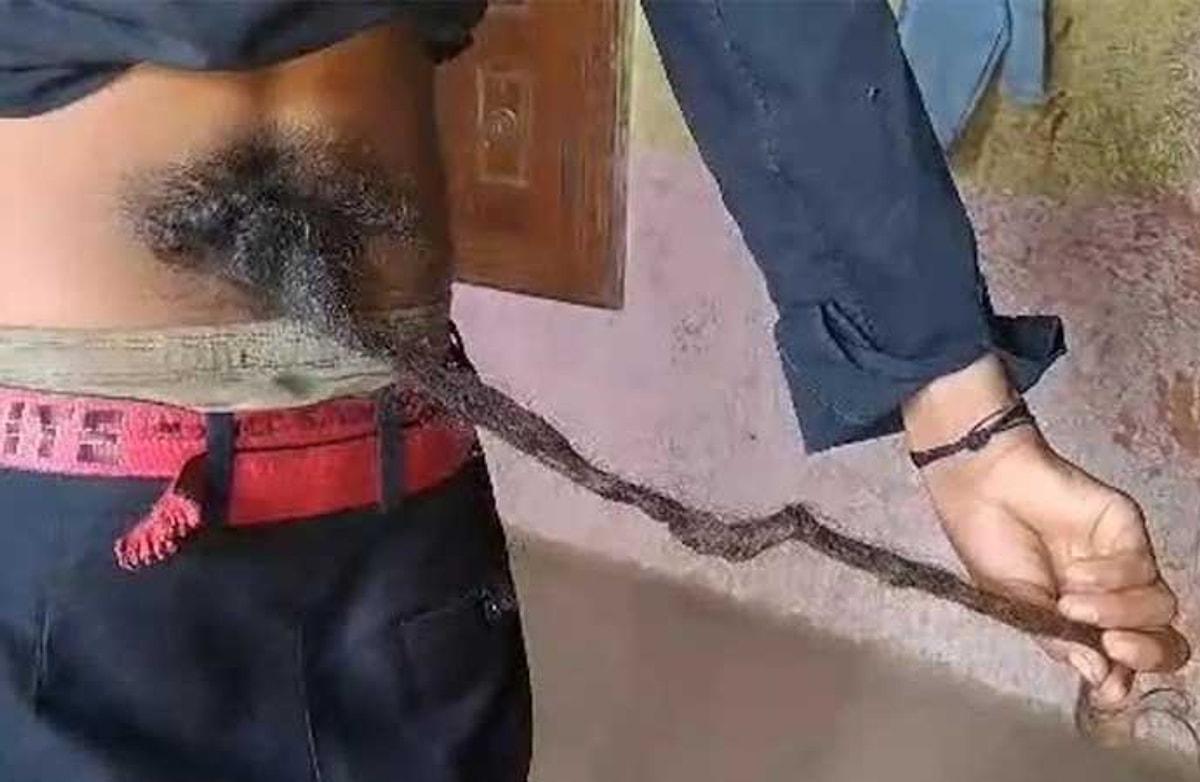 Hindistan’da belinde 60 cm’lik kuyruk çıkan çocuğu ’Tanrı’ ilan ettiler
