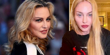 Ölümden-dönen-Madonna'dan-açıklama--Hayatta-olduğum-için-şanslı-hissediyorum