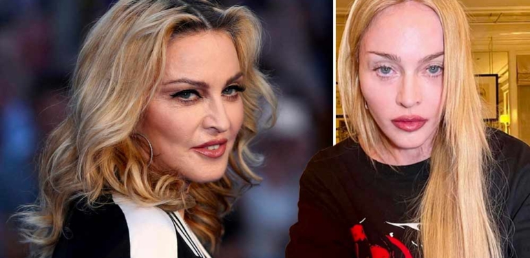 Ölümden dönen Madonna’dan açıklama: Hayatta olduğum için şanslı hissediyorum