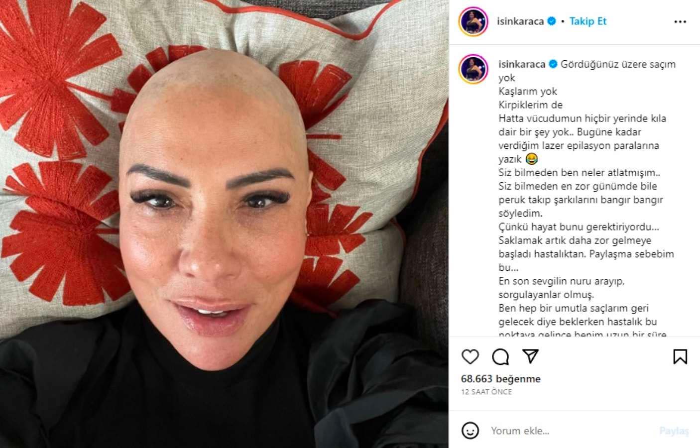 İki yıldır tedavi gören Işın Karaca hastalığını açıkladı: 'Saklamak artık daha zor gelmeye başladı...'