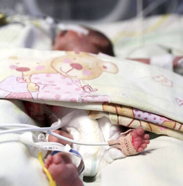 Dünyaya 750 gram gelen minik Batu anne sütüyle hayata tutunuyor 2 Dünyaya-750-gram-gelen-minik-Batu-anne-sütüyle-hayata-tutunuyor