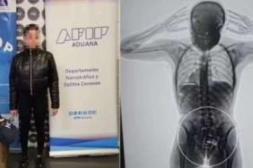 X-ray cihazına takıldı, gerçek ortaya çıktı!