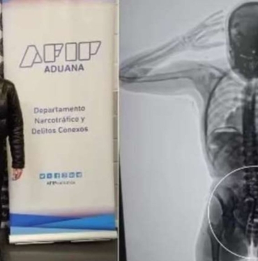X-ray cihazına takıldı, gerçek ortaya çıktı! 10 X-ray cihazına takıldı, gerçek ortaya çıktı!