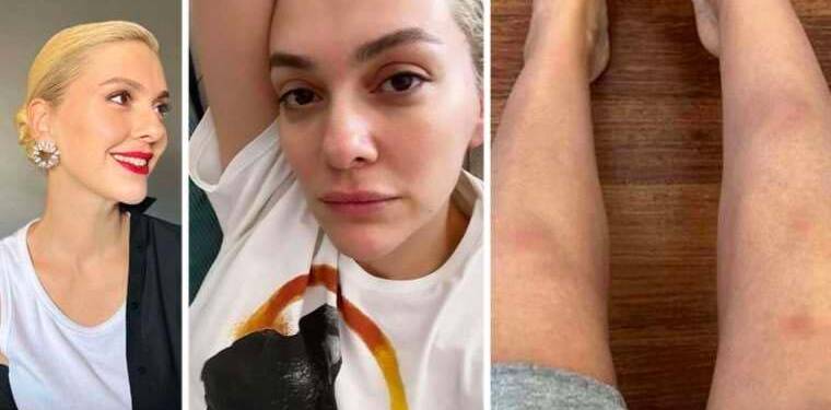 Bergüzar Korel ‘oyunculuğun zorluklarını’ anlattı, sosyal medya ikiye bölündü: ‘Duyan da asgari ücrete çalışıyor sanır!’