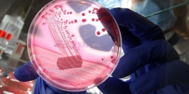 Uluslararası yumurtalık kanseri uygulaması Olivia Türkçe de hizmet verecek