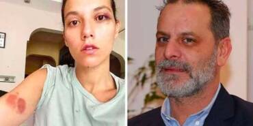 Deniz Bulutsuz'a şiddet uyguladığı iddiasıyla yargılanan Ozan Güven sessizliğini bozdu 4 Deniz-Bulutsuz'a-şiddet-uyguladığı-iddiasıyla-yargılanan-Ozan-Güven-sessizliğini-bozdu