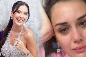 Dilan-Polat-gözyaşları-içinde-açıkladı--Tedavisi-olmayan-Lupus-(Kelebek)-hastalığına-yakalandı