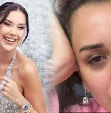 Dilan-Polat-gözyaşları-içinde-açıkladı--Tedavisi-olmayan-Lupus-(Kelebek)-hastalığına-yakalandı