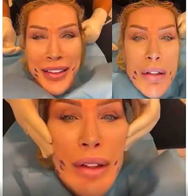 Seda Sayan’ın ablası da gençleşmek için bıçak altına yattı... Görenler tanıyamadı! 4 Seda Sayan’ın ablası da gençleşmek için bıçak altına yattı... Görenler tanıyamadı!