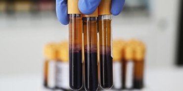 Kan testiyle hızlı ve yavaş yaşlanan organlar tespit edilebilir