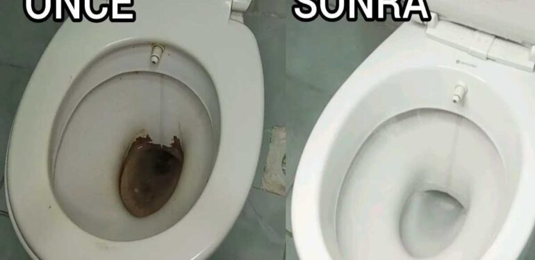 Çamaşır suyundan çok daha etkiliymiş! 1 kaşığı bile klozeti hızlıca temizliyor