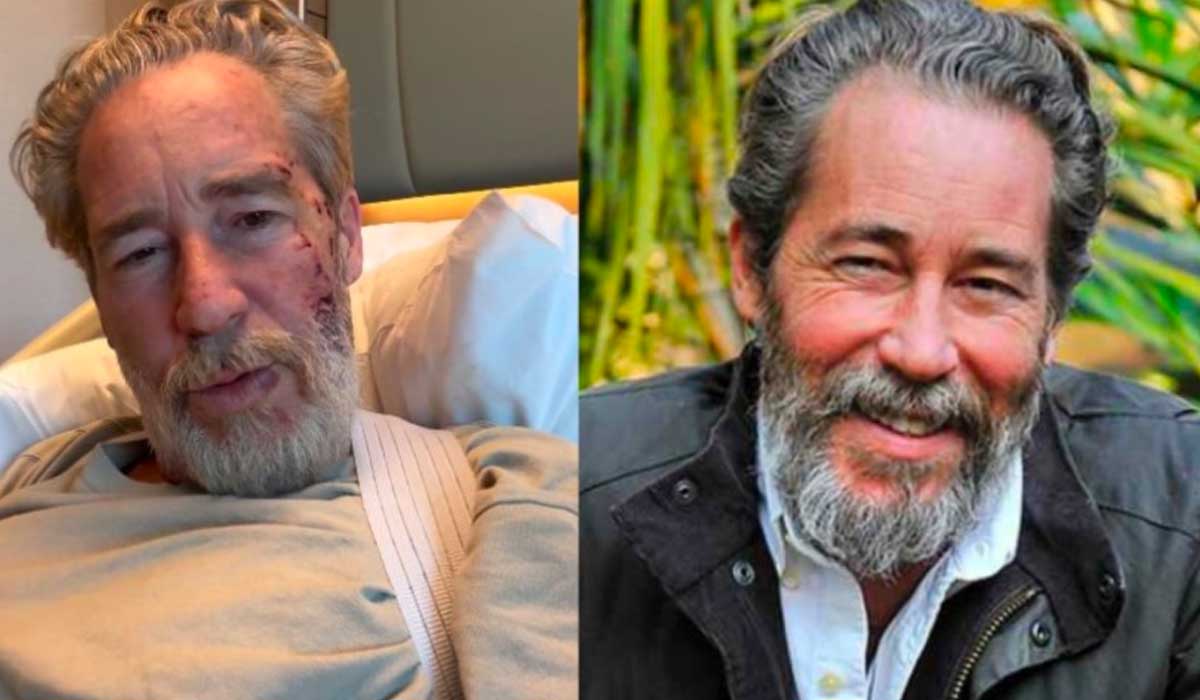 Dizi setinde kaza geçirmişti... Sinan Albayrak'tan ilk açıklama: 'Çok fazla konuşacak mecalim yok' 4 Dizi-setinde-kaza-geçiren-Sinan-Albayrak'tan-ilk-açıklama