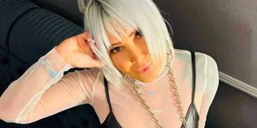 Yonca-Evcimik-yüzündeki-değişimle-gündem-oldu!