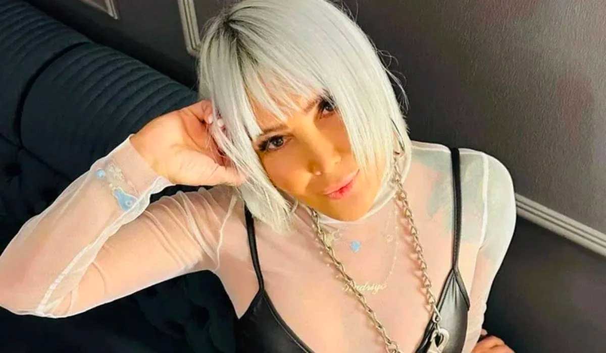 Yonca-Evcimik-yüzündeki-değişimle-gündem-oldu!