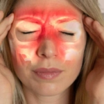 Sinüzit-sorunu-artık-baş-ağrıtmayacak