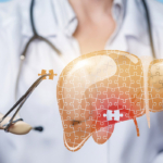 Karaciğer Sağlığınızı Korumak İçin Öneriler: Akdeniz Diyeti, Doğal Besinler ve Yaşam Tarzı 35 karaciğer-sağlığı