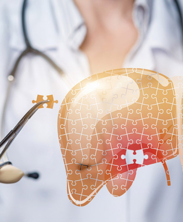 Karaciğer Sağlığınızı Korumak İçin Öneriler: Akdeniz Diyeti, Doğal Besinler ve Yaşam Tarzı 10 karaciğer-sağlığı