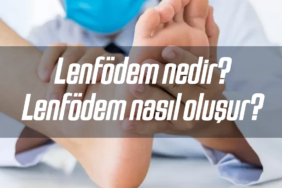 Fil hastalığı olarak da bilinen Lenfödem nedir? Lenfödem nasıl oluşur? 8 lenfodem-nedir