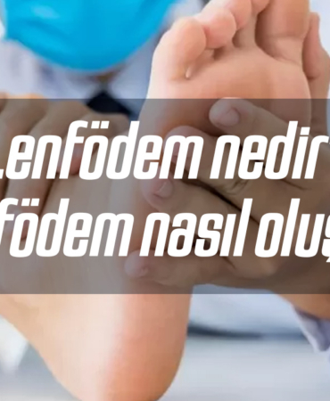 Fil hastalığı olarak da bilinen Lenfödem nedir? Lenfödem nasıl oluşur? 8 lenfodem-nedir