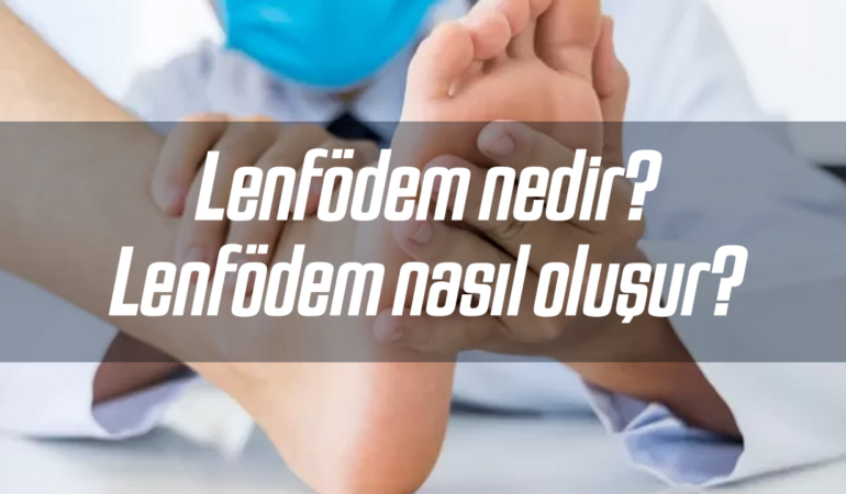 Fil hastalığı olarak da bilinen Lenfödem nedir? Lenfödem nasıl oluşur?